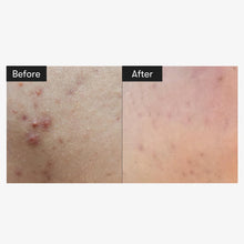 Load image into Gallery viewer, VT REEDLE SHOT 100.