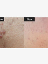 Load image into Gallery viewer, VT Mild Reedle Shot 50.